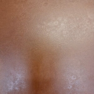 Iron Rust